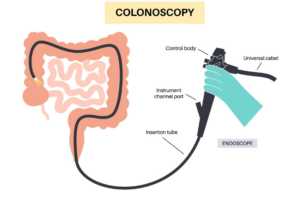 Βασικές Οδηγίες πριν την Κολονοσκόπηση